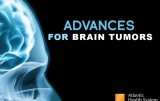 ADVANCES FOR BRAIN TUMORS