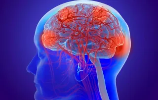 brain surgery