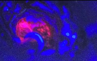 Fluorescent imaging